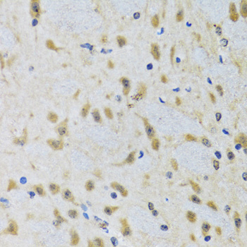 Apg7 / ATG7 Antibody - Immunohistochemistry of paraffin-embedded rat brain using ATG7 antibodyat dilution of 1:100 (40x lens).