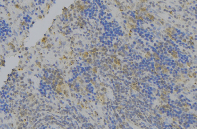 Apg7 / ATG7 Antibody - 1:100 staining human lymph node tissue by IHC-P. The sample was formaldehyde fixed and a heat mediated antigen retrieval step in citrate buffer was performed. The sample was then blocked and incubated with the antibody for 1.5 hours at 22°C. An HRP conjugated goat anti-rabbit antibody was used as the secondary.