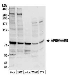 APH / APEH Antibody - Detection of human and mouse APEH/AARE by western blot. Samples: Whole cell lysate (50 µg) from HeLa, HEK293T, Jurkat, mouse TCMK-1, and mouse NIH 3T3 cells prepared using NETN lysis buffer. Antibody: Affinity purified rabbit anti-APEH/AARE antibody used for WB at 0.1 µg/ml. Detection: Chemiluminescence with an exposure time of 10 seconds.
