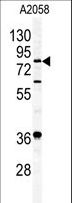 APH / APEH Antibody - Western blot of APEH antibody in A2058 cell line lysates (35 ug/lane). APEH (arrow) was detected using the purified antibody.
