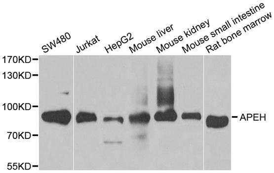 APH / APEH Antibody - Western blot analysis of extracts of various cell lines.