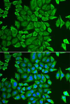 APH / APEH Antibody - Immunofluorescence analysis of HeLa cells.