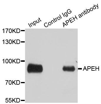 APH / APEH Antibody - Immunoprecipitation analysis of 100ug extracts of SW480 cells.
