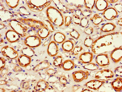 APH / APEH Antibody - Immunohistochemistry of paraffin-embedded human renal tissue using APEH Antibody at dilution of 1:100