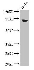 APH / APEH Antibody - Western Blot Positive WB detected in: Hela whole cell lysate, Mouse liver tissue All lanes: APEH antibody at 3µg/ml Secondary Goat polyclonal to rabbit IgG at 1/50000 dilution Predicted band size: 82 kDa Observed band size: 82 kDa
