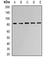 APH / APEH Antibody - Western blot analysis of APEH expression in Jurkat (A); HepG2 (B); mouse liver (C); mouse kidney (D); rat bone marrow (E) whole cell lysates.