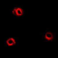 APH / APEH Antibody - Immunofluorescent analysis of APEH staining in HeLa cells. Formalin-fixed cells were permeabilized with 0.1% Triton X-100 in TBS for 5-10 minutes and blocked with 3% BSA-PBS for 30 minutes at room temperature. Cells were probed with the primary antibody in 3% BSA-PBS and incubated overnight at 4 deg C in a humidified chamber. Cells were washed with PBST and incubated with a DyLight 594-conjugated secondary antibody (red) in PBS at room temperature in the dark.