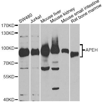 APH / APEH Antibody - Western blot analysis of extracts of various cell lines, using APEH antibody at 1:1000 dilution. The secondary antibody used was an HRP Goat Anti-Rabbit IgG (H+L) at 1:10000 dilution. Lysates were loaded 25ug per lane and 3% nonfat dry milk in TBST was used for blocking. An ECL Kit was used for detection and the exposure time was 30s.