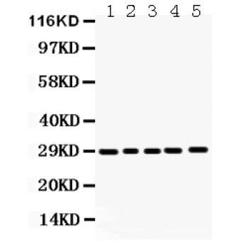 APH1A / APH-1 Antibody - APH1a antibody Western blot. All lanes: Anti APH1a at 0.5 ug/ml. Lane 1: Mouse Lung Tissue Lysate at 50 ug. Lane 2: Mouse Liver Tissue Lysate at 50 ug. Lane 3: SW620 Whole Cell Lysate at 40 ug. Lane 4: SMMC Whole Cell Lysate at 40 ug. Lane 5: Human Placenta Tissue Lysate at 50 ug. Predicted band size: 29 kD. Observed band size: 29 kD.