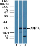 APH1A / APH-1 Antibody - Western blot of APH1A in 1) human lung lysate using pre bleed at 1:5000, 2) human lung lysate using Polyclonal Antibody to APH1A at 5 ug/ml and 3) rat lung lysate using Polyclonal Antibody to APH1A at 4 ug/ml. Goat anti-rabbit Ig HRP secondary antibody, and PicoTect ECL substrate solution were used for this test.