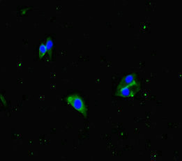 APH1A / APH-1 Antibody - Immunofluorescent analysis of Hela cells diluted at 1:100 and Alexa Fluor 488-congugated AffiniPure Goat Anti-Rabbit IgG(H+L)