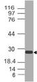 APH1A / APH-1 Antibody - Fig-1: Expression analysis of APH1A. Anti-APH1A antibody was used at 1 µg/ml on h Spleen lysate.