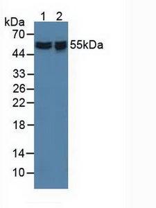 API5 Antibody - Western Blot; Sample: Lane1: Human Hela Cells; Lane2: Human 293T Cells.