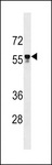 API5 Antibody - API5 Antibody western blot of CEM cell line lysates (35 ug/lane). The API5 antibody detected the API5 protein (arrow).