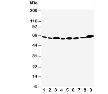 API5 Antibody - Western blot testing of Apoptosis Inhibitor 5 antibody and Lane 1: rat heart; 2: rat brain; 3: rat testis; 4: rat placenta; 5: MCF-7; 6: HeLa; 7: CEM; 8: SMMC-7721; 9: COLO320 cell lysate