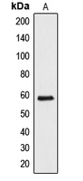 API5 Antibody - Western blot analysis of API5 expression in HeLa (A) whole cell lysates.