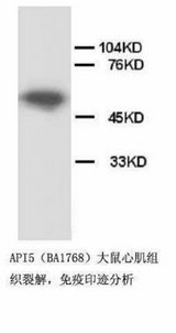API5 Antibody -  This image was taken for the unconjugated form of this product. Other forms have not been tested.