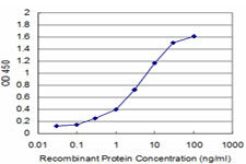 API5 Antibody - Detection limit for recombinant GST tagged API5 is approximately 0.1 ng/ml as a capture antibody.