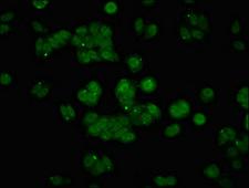 API5 Antibody - Immunofluorescent analysis of HepG2 cells at a dilution of 1:100 and Alexa Fluor 488-congugated AffiniPure Goat Anti-Rabbit IgG(H+L)
