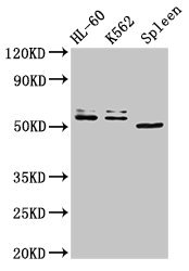 API5 Antibody - Western Blot Positive WB detected in: HL60 whole cell lysate, K562 whole cell lysate, Mouse spleen tissue All lanes: API5 antibody at 3µg/ml Secondary Goat polyclonal to rabbit IgG at 1/50000 dilution Predicted band size: 60, 50, 57, 51, 58 kDa Observed band size: 60, 50 kDa