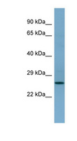 APIP Antibody - APIP antibody Western blot of 721_B cell lysate. This image was taken for the unconjugated form of this product. Other forms have not been tested.