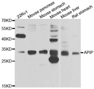 APIP Antibody - Western blot analysis of extracts of various cell lines.