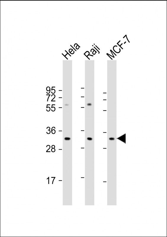 APIP Antibody - All lanes: Anti-APIP Antibody (Center) at 1:2000 dilution Lane 1: Hela whole cell lysate Lane 2: Raji whole cell lysate Lane 3: MCF-7 whole cell lysate Lysates/proteins at 20 µg per lane. Secondary Goat Anti-Rabbit IgG, (H+L), Peroxidase conjugated at 1/10000 dilution. Predicted band size: 27 kDa Blocking/Dilution buffer: 5% NFDM/TBST.