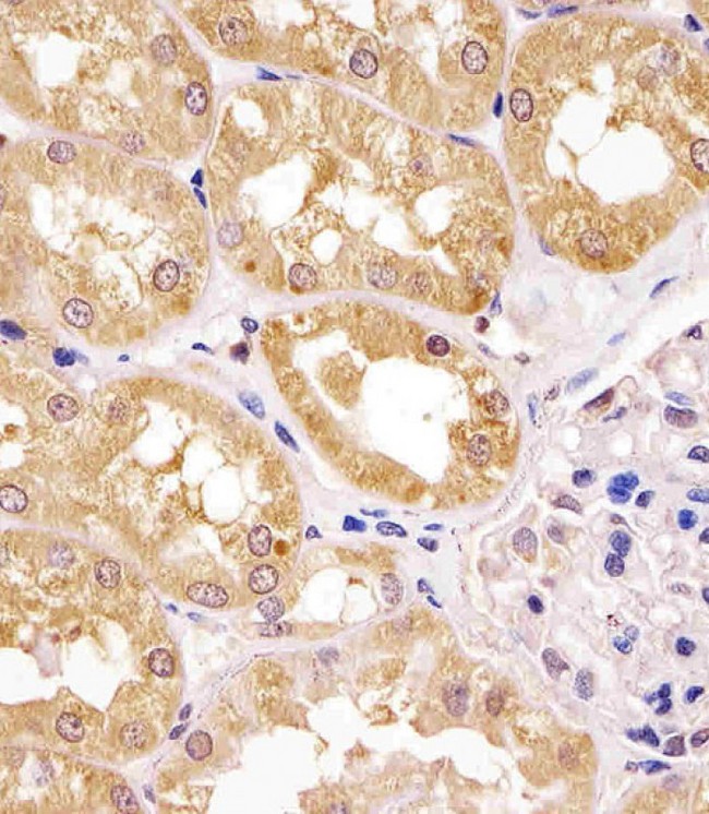 APIP Antibody - APIP Antibody (Center) staining APIP in human kidney tissue sections by Immunohistochemistry (IHC-P - paraformaldehyde-fixed, paraffin-embedded sections). Tissue was fixed with formaldehyde and blocked with 3% BSA for 0. 5 hour at room temperature; antigen retrieval was by heat mediation with a citrate buffer (pH6). Samples were incubated with primary antibody (1/25) for 1 hours at 37°C. A undiluted biotinylated goat polyvalent antibody was used as the secondary antibody.