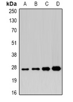 APIP Antibody - Western blot analysis of APIP expression in 22RV1 (A); mouse heart (B); mouse liver (C); rat stomach (D) whole cell lysates.