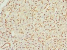 APIP Antibody - Immunohistochemistry of paraffin-embedded human pancreatic tissue at dilution 1:100