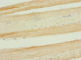 APIP Antibody - Immunohistochemistry of paraffin-embedded human skeletal muscle tissue at dilution 1:100