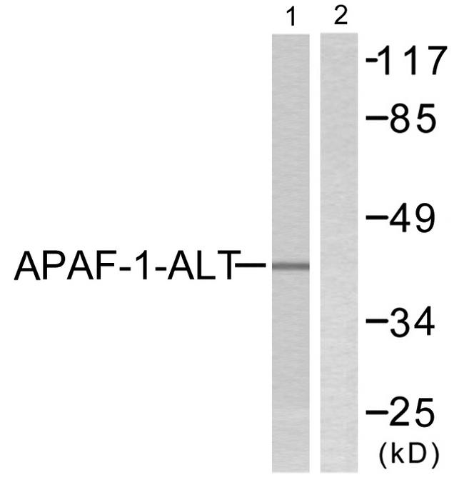 APIP Antibody - Western blot analysis of extracts from COLO205, using APAF-1-ALT antibody.