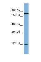 APIP Antibody - Western blot of Human MCF7. APIP antibody dilution 1.0 ug/ml.  This image was taken for the unconjugated form of this product. Other forms have not been tested.