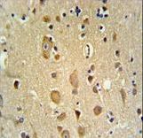 APITD1 Antibody - APITD1 Antibody IHC of formalin-fixed and paraffin-embedded brain tissue followed by peroxidase-conjugated secondary antibody and DAB staining.