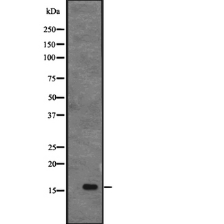APITD1 Antibody - Western blot analysis of CENPS expression in MHF1 transfected 293T cells lysate. The lane on the left is treated with the antigen-specific peptide.