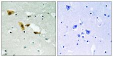 APLF / PALF Antibody - Immunohistochemistry analysis of paraffin-embedded human brain tissue, using APLF Antibody. The picture on the right is blocked with the synthesized peptide.