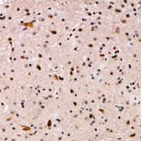 APLF / PALF Antibody - Immunohistochemical analysis of PALF staining in human brain formalin fixed paraffin embedded tissue section. The section was pre-treated using heat mediated antigen retrieval with sodium citrate buffer (pH 6.0). The section was then incubated with the antibody at room temperature and detected using an HRP conjugated compact polymer system. DAB was used as the chromogen. The section was then counterstained with haematoxylin and mounted with DPX.
