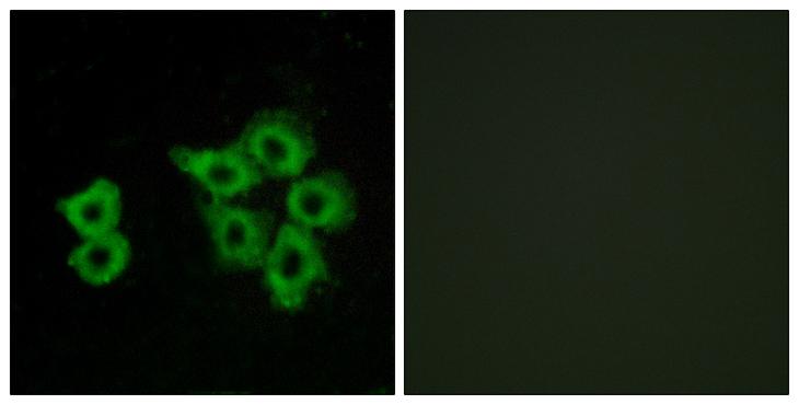 APLNR/ Apelin Receptor / APJ Antibody - Peptide - + Immunofluorescence analysis of MCF-7 cells, using AGTRL1 antibody.