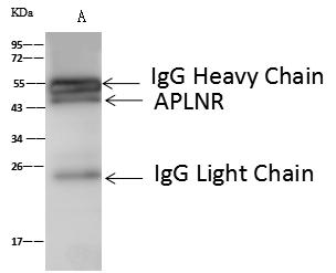 APLNR/ Apelin Receptor / APJ Antibody - APLNR was immunoprecipitated using: Lane A: 0.5 mg Mouse heart tissue lysate. 4 uL anti-APLNR rabbit polyclonal antibody and 60 ug of Immunomagnetic beads Protein A/G. Primary antibody: Anti-APLNR rabbit polyclonal antibody, at 1:100 dilution. Secondary antibody: Goat Anti-Rabbit IgG (H+L)/HRP at 1/10000 dilution. Developed using the ECL technique. Performed under reducing conditions. Predicted band size: 43 kDa. Observed band size: 45 kDa.
