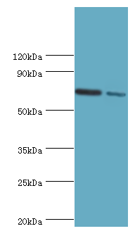 APLP1 / APLP-1 Antibody - Western blot. All lanes: Amyloid-like protein 1 antibody at 6 ug/ml. Lane 1: mouse brain tissue. Lane 2: A549 whole cell lysate. Secondary antibody: Goat polyclonal to rabbit at 1:10000 dilution. Predicted band size: 72 kDa. Observed band size: 72 kDa.