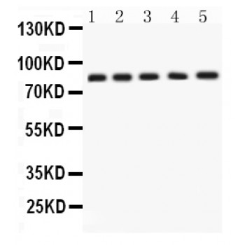 APLP1 / APLP-1 Antibody - APLP1 antibody Western blot. All lanes: Anti APLP1 at 0.5 ug/ml. Lane 1: Rat Brain Tissue Lysate at 50 ug. Lane 2: Rat Testis Tissue Lysate at 50 ug. Lane 3: SGC Whole Cell Lysate at 40 ug. Lane 4: 22RV1 Whole Cell Lysate at 40 ug. Lane 5: MCF-7 Whole Cell Lysate at 40 ug. Predicted band size: 72 kD. Observed band size: 85 kD.