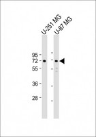 APLP1 / APLP-1 Antibody - All lanes: Anti-APLP1 Antibody (C-Term) at 1:2000 dilution Lane 1: U-251 MG whole cell lysate Lane 2: U-87 MG whole cell lysate Lysates/proteins at 20 µg per lane. Secondary Goat Anti-Rabbit IgG, (H+L), Peroxidase conjugated at 1/10000 dilution. Predicted band size: 72 kDa Blocking/Dilution buffer: 5% NFDM/TBST.