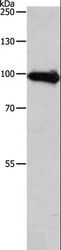 APLP1 / APLP-1 Antibody - Western blot analysis of Human fetal brain tissue, using APLP1 Polyclonal Antibody at dilution of 1:650.