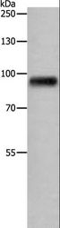 APLP1 / APLP-1 Antibody - Western blot analysis of Human fetal brain tissue, using APLP1 Polyclonal Antibody at dilution of 1:650.