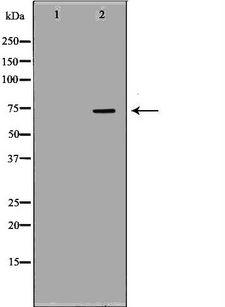 APLP1 / APLP-1 Antibody - Western blot analysis of extracts of mouse brain tissue using APLP1 antibody. The lane on the left is treated with the antigen-specific peptide.
