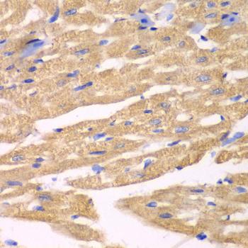 APLP1 / APLP-1 Antibody - Immunohistochemistry of paraffin-embedded Mouse heart using APLP1 Polyclonal Antibody at dilution of 1:100 (40x lens).