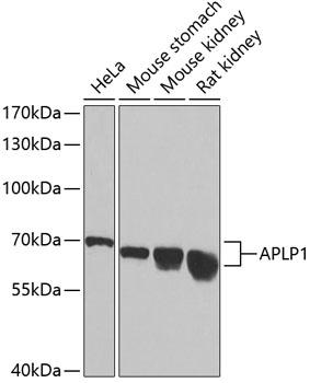APLP1 / APLP-1 Antibody - Western blot analysis of extracts of various cell lines using APLP1 Polyclonal Antibody at dilution of 1:1000.