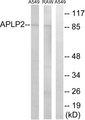 APLP2 Antibody - Western blot analysis of lysates from RAW264.7 and A549 cells, using APLP2 Antibody. The lane on the right is blocked with the synthesized peptide.
