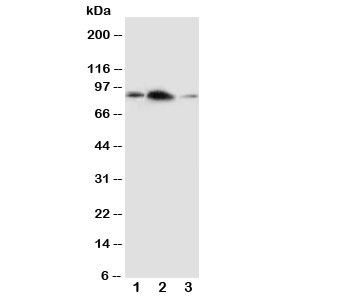 APLP2 Antibody - Western blot testing of APLP2 antibody and Lane 1: rat brain; 2: rat heart; 3: human SMMC-7721 cell lysate