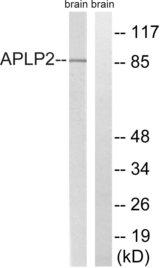 APLP2 Antibody - Western blot analysis of lysates from rat brain, using APLP2 Antibody. The lane on the right is blocked with the synthesized peptide.